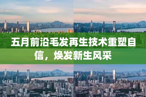五月前沿毛发再生技术重塑自信，焕发新生风采